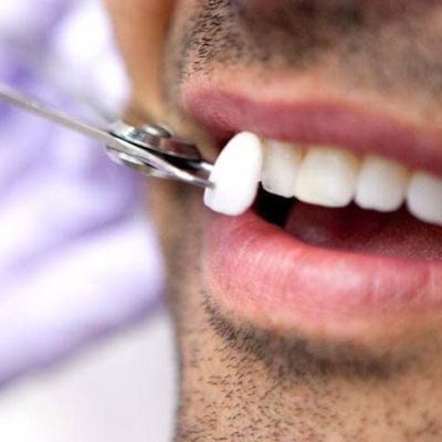 Cuidados dentales personalizados en clínica de odontología